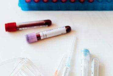 Oproep gemist van +31887308686. Wie belt